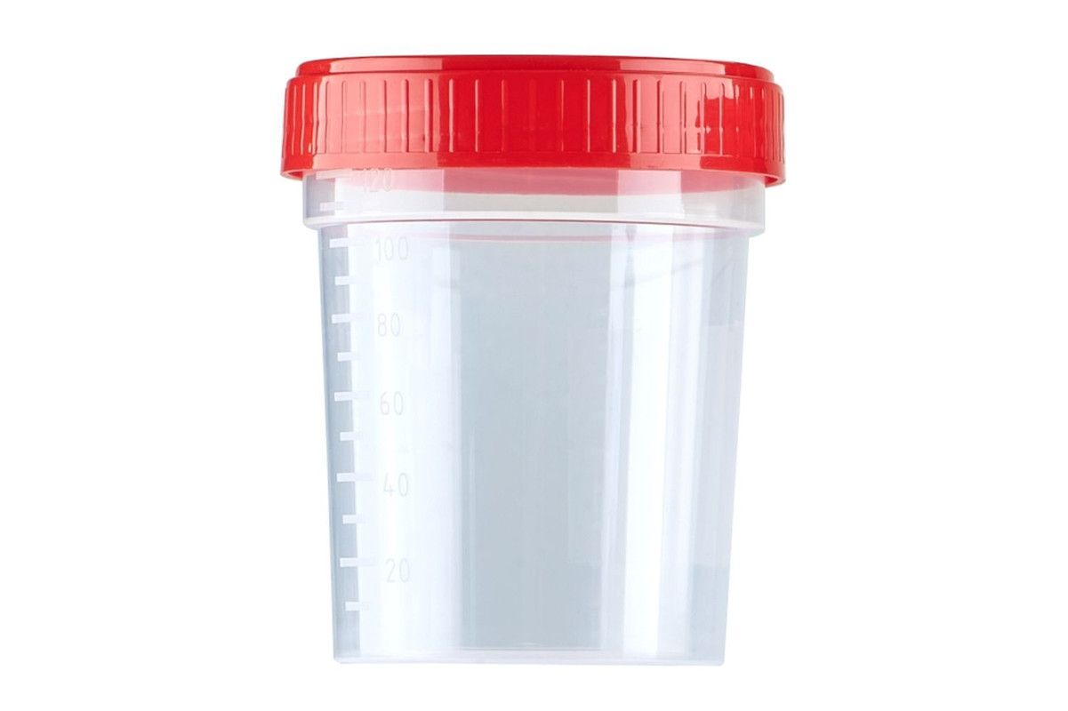 Контейнер лабораторний пластиковий 120 мл для біологічних матеріалів